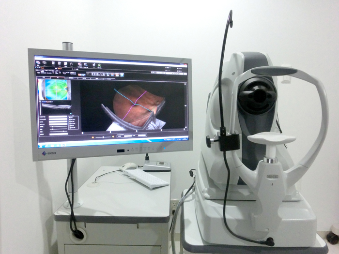 OCT(OCT（optical coherence tomography）